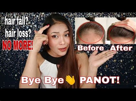 pampatubo ng buhok ng aso|EFFECTIVE NA PAMPATUBO,PAMPAKAPAL AT .